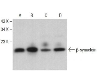 beta Synuclein Antibody (8) - Western Blotting - Image 379611 