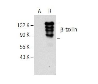&beta;-taxilin Antibody (A-5) - Western Blotting - Image 283881 