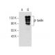 β-taxilin Antibody (A-5) - Western Blotting - Image 283881 