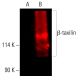 β-taxilin Antibody (A-5) - Western Blotting - Image 402089 
