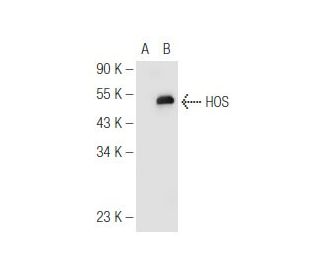 western blotting image from recommended &beta;-TrCP/HOS (F-10) monoclonal antibody replacement. Image 81195