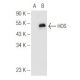 western blotting image from recommended β-TrCP/HOS (F-10) monoclonal antibody replacement. Image 81195