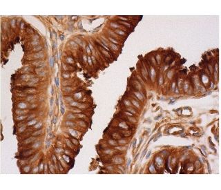 beta Tubulin Antibody (37) - Immunohistochemistry - Image 286488 
