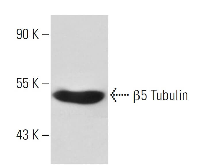 beta Tubulin Antibody D 10 SCBT Santa Cruz Biotechnology