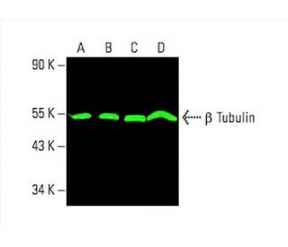 beta Tubulin Antibody D 10 SCBT Santa Cruz Biotechnology