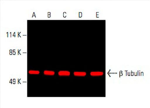 beta Tubulin Antibody D 10 SCBT Santa Cruz Biotechnology