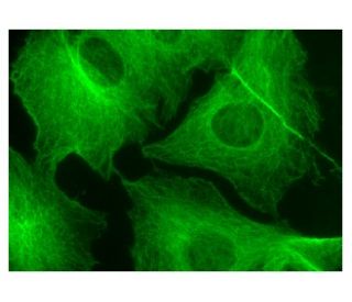 KUNIページ beta Tubulin Antibody (F-1) | SCBT - Santa Cruz Biotechnology