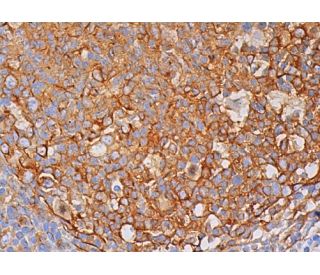 beta-tubulin-antibody-f-1-