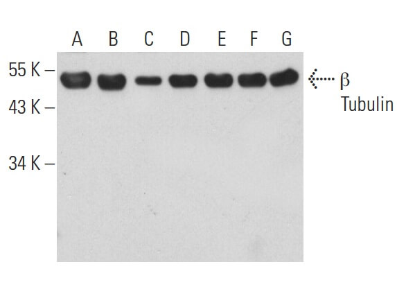 いづページ beta-tubulin-antibody-f-1-
