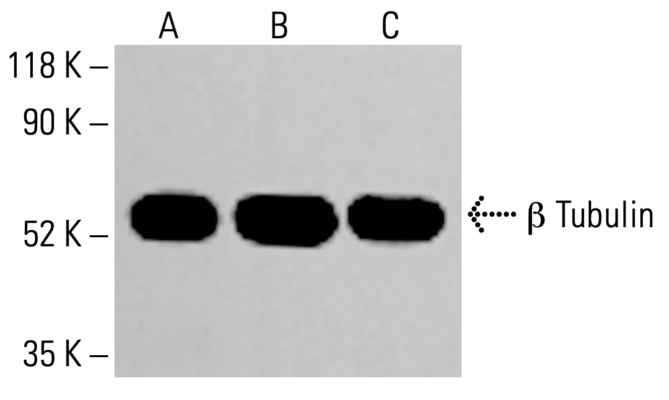 beta Tubulin Antibody (F-1) | SCBT - Santa Cruz Biotechnology