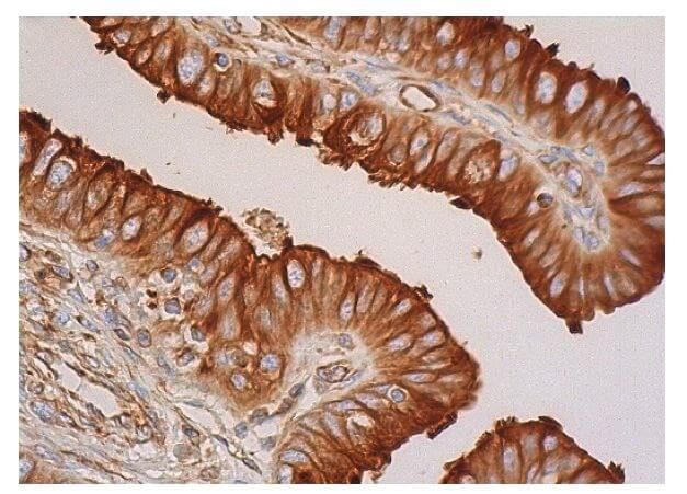 beta Tubulin Antibody G 8 SCBT Santa Cruz Biotechnology