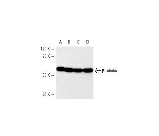 western blotting image from recommended beta Tubulin (D-10) monoclonal antibody replacement. Image 5457