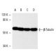 western blotting image from recommended beta Tubulin (D-10) monoclonal antibody replacement. Image 5457