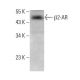 beta 2 Adrenergic Receptor/ADRB2/β2-AR Antibody (E-3) - Western Blotting - Image 379893 