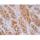 immunohistochemistry image from recommended beta 2 Adrenergic Receptor/ADRB2/β2-AR (E-3) monoclonal antibody replacement. Image 391587