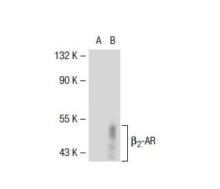 beta 2 Adrenergic Receptor/ADRB2/&beta;2-AR Antibody (I3D6) - Western Blotting - Image 38370