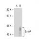 beta 2 Adrenergic Receptor/ADRB2/β2-AR Antibody (I3D6) - Western Blotting - Image 38370