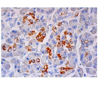 beta 2 Adrenergic Receptor/ADRB2/&beta;2-AR Antibody (R11E1) - Immunohistochemistry - Image 284807 