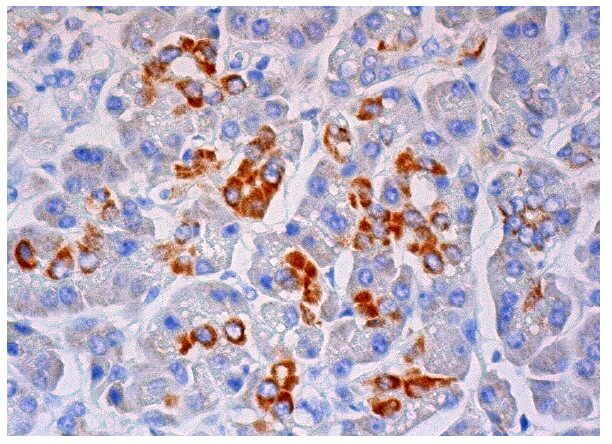 Anti-beta 2 Adrenergic Receptor/ADRB2/β2-AR Antibody (R11E1) | SCBT ...