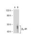 beta 2 Adrenergic Receptor/ADRB2/β2-AR Antibody (R11E1) - Western Blotting - Image 38372