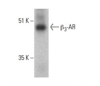 western blotting image from recommended beta 3 Adrenergic Receptor/ADRB3/&beta;3-AR (C-5) monoclonal antibody replacement. Image 363287