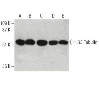&beta;3 Tubulin Antibody (AA10) - Western Blotting - Image 396414 