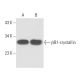 βB1-crystallin Antibody (H-3) - Western Blotting - Image 11040