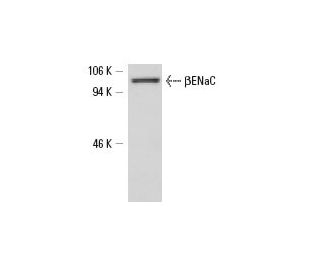 western blotting image from recommended &beta;ENaC (D-3) monoclonal antibody replacement. Image 6585