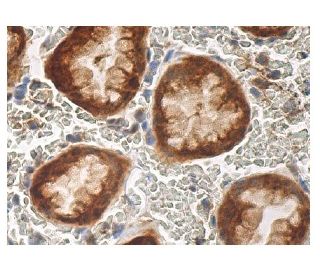 &beta;ENaC Antibody (D-3) - Immunohistochemistry - Image 156804 