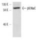βENaC Antibody (E-10) - Western Blotting - Image 12764