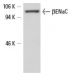 This polyclonal antibody has been discontinued. See our recommended <a href="betaenac-antibody-d-3">βENaC (D-3)</a> monoclonal antibody (sample data shown). western blotting image from recommended βENaC (D-3) monoclonal antibody replacement. Image 6585
