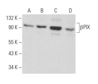western blotting image from recommended &beta;PIX (H-3) monoclonal antibody replacement. Image 357167