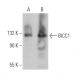 BICC1 Antibody (A-12) - Western Blotting - Image 370034 
