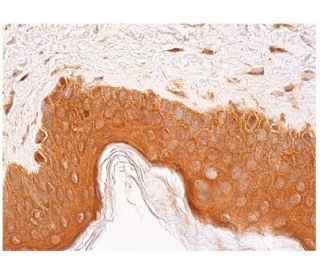 BICD2 Antibody (E-12) - Immunohistochemistry - Image 346190 