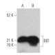 western blotting image from recommended BID (B-3) monoclonal antibody replacement. Image 361489