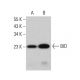 BID Antibody (F-5) - Western Blotting - Image 377093 