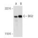 BIG2 Antibody (H-6) - Western Blotting - Image 300489 