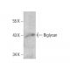 Biglycan Antibody (910E2) - Western Blotting - Image 386116