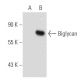 western blotting image from recommended Biglycan (3E2) monoclonal antibody replacement. Image 55188