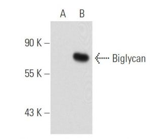 Biglycan Antibody (3E2) - Western Blotting - Image 55188The Double Nickase Plasmid features a U6 promoter for sgRNA expression, a 20 nt targeting sequence, and a gRNA scaffold to guide Cas9n. It includes a CBh promoter for Cas9n (D10A) and puromycin resistance, GFP for transfection verification, and nuclear localization signals (NLS). The 2A peptide allows co-expression of Cas9n and Puro from a single promoter, enabling precise genome editing with reduced off-target effects.