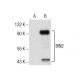 BIN2 Antibody (B-10) - Western Blotting - Image 157839