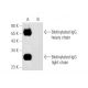 Biotin Antibody (39-15D9) - Western Blotting - Image 57975