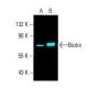 Biotin Antibody (BK-1/39) - Western Blotting - Image 395849 