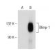 PRDM1/Blimp-1 Antibody (3H2E8) - Western Blotting - Image 149015