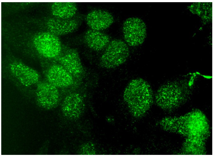 blm-antibody-b-4-