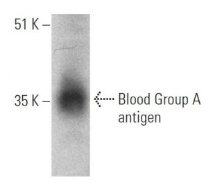 Blood Group A antigen Antibody (HE-10) - Western Blotting - Image 368563