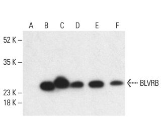 BLVRB Antibody (B-9) - Western Blotting - Image 404263The Double Nickase Plasmid features a U6 promoter for sgRNA expression, a 20 nt targeting sequence, and a gRNA scaffold to guide Cas9n. It includes a CBh promoter for Cas9n (D10A) and puromycin resistance, GFP for transfection verification, and nuclear localization signals (NLS). The 2A peptide allows co-expression of Cas9n and Puro from a single promoter, enabling precise genome editing with reduced off-target effects. 
