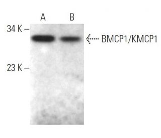 BMCP1/KMCP1 Antibody (F-3) - Western Blotting - Image 374924 