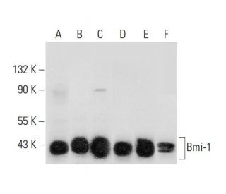 western blotting image from recommended Bmi-1 (F-9) monoclonal antibody replacement. Image 308647