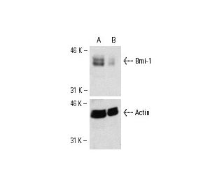 Bmi-1 siRNA (h): sc-29814. Western blot analysis of Bmi-1 expression in non-transfected control (A) and Bmi-1 siRNA transf 